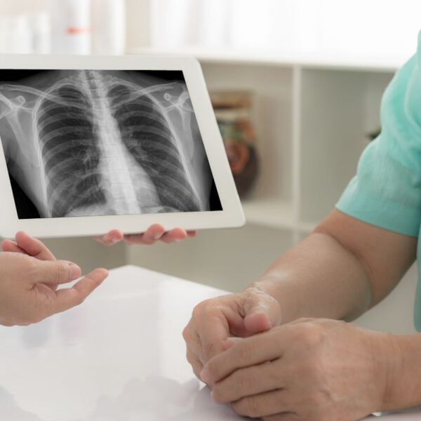XPERT Home X-Ray
