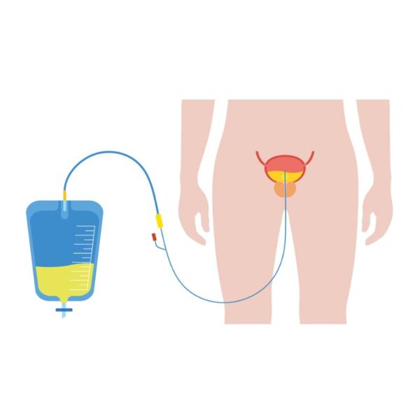 XPERT Home Urinary Catheterization